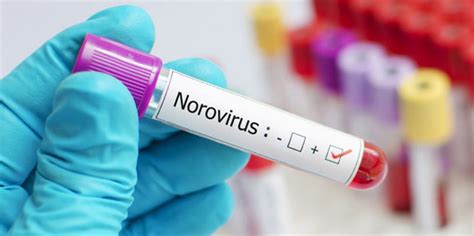 norovirus meldepflicht